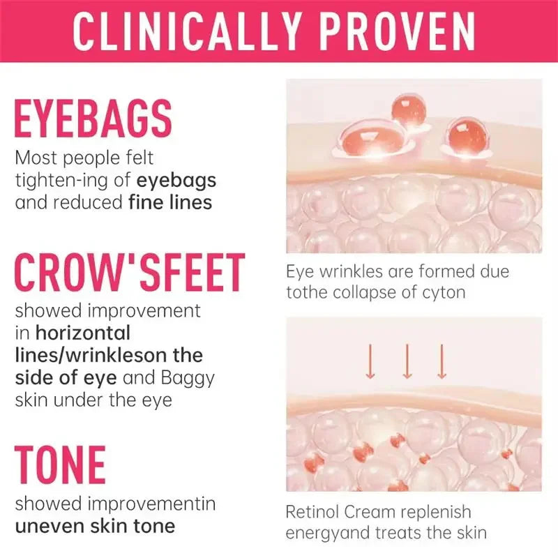 Eye Bag Removal Cream Collagen Anti-Wrinkle Fade Fine Lines Firming Skin Anti Dark Circle Puffiness Brighten Eye Care